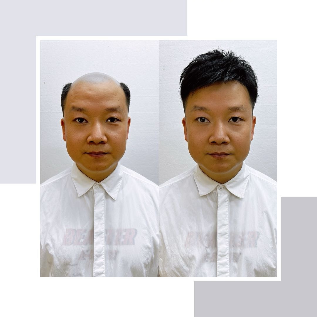 深圳假发补发圣哥