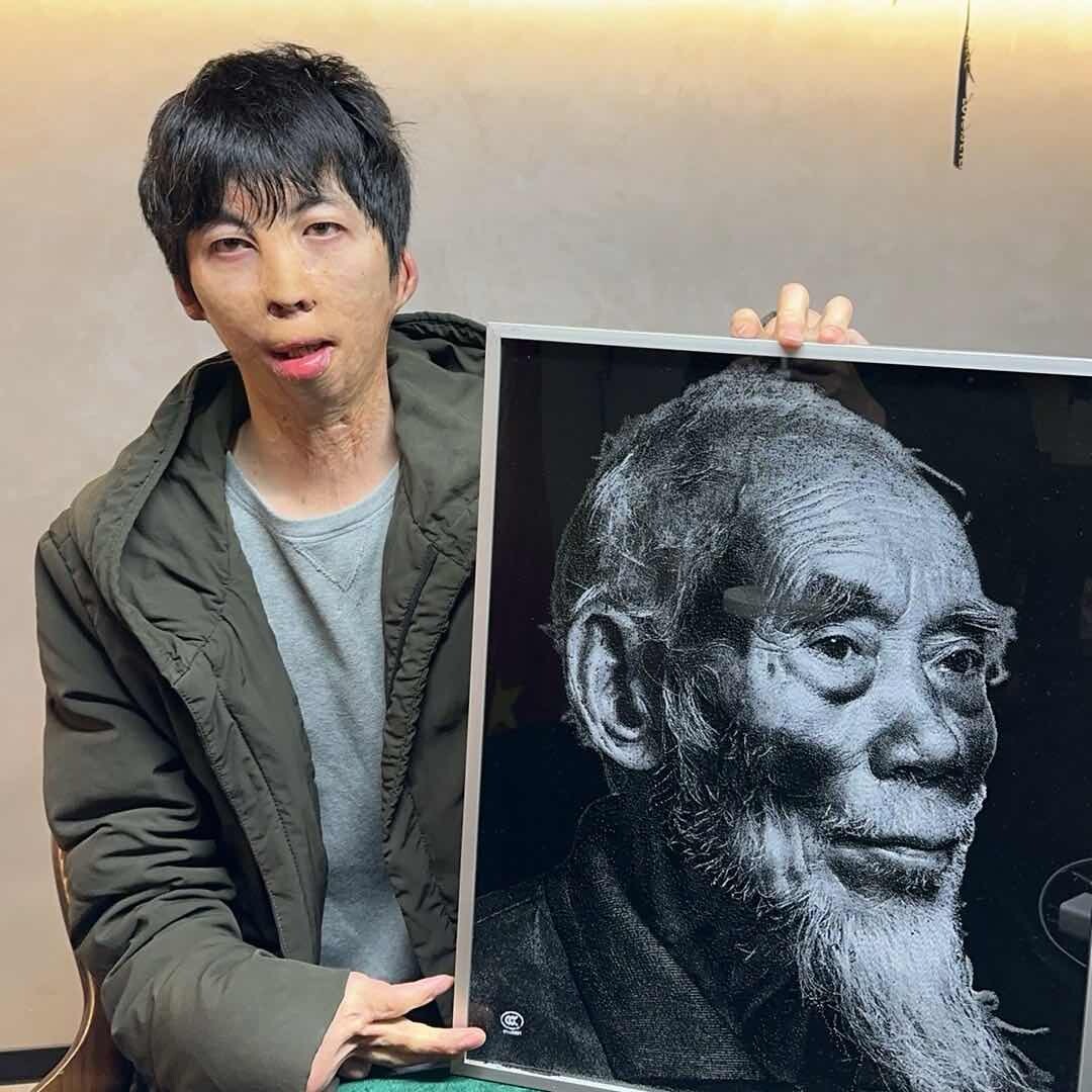 烧伤小哥会非遗