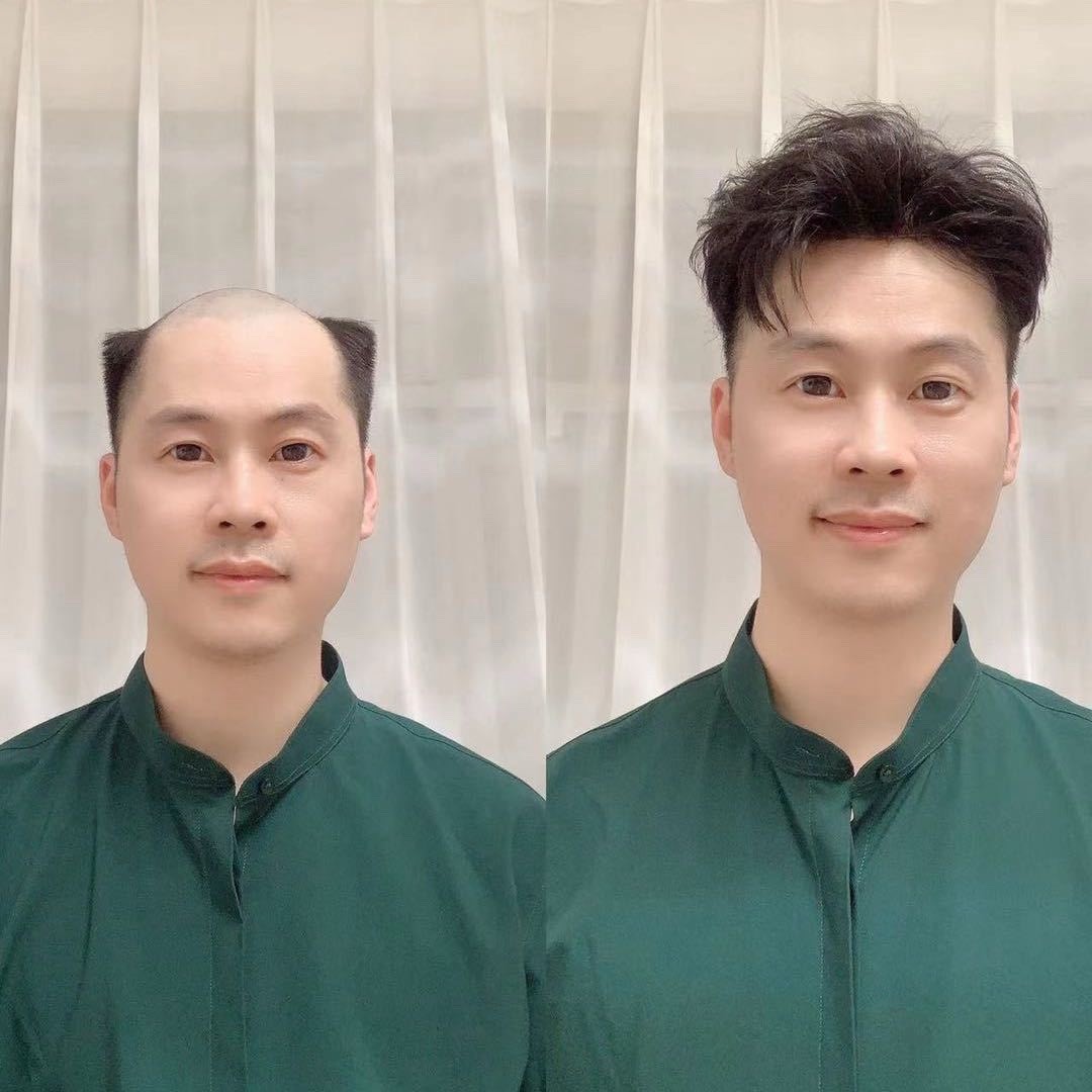 安徽宁国假发枣阿明