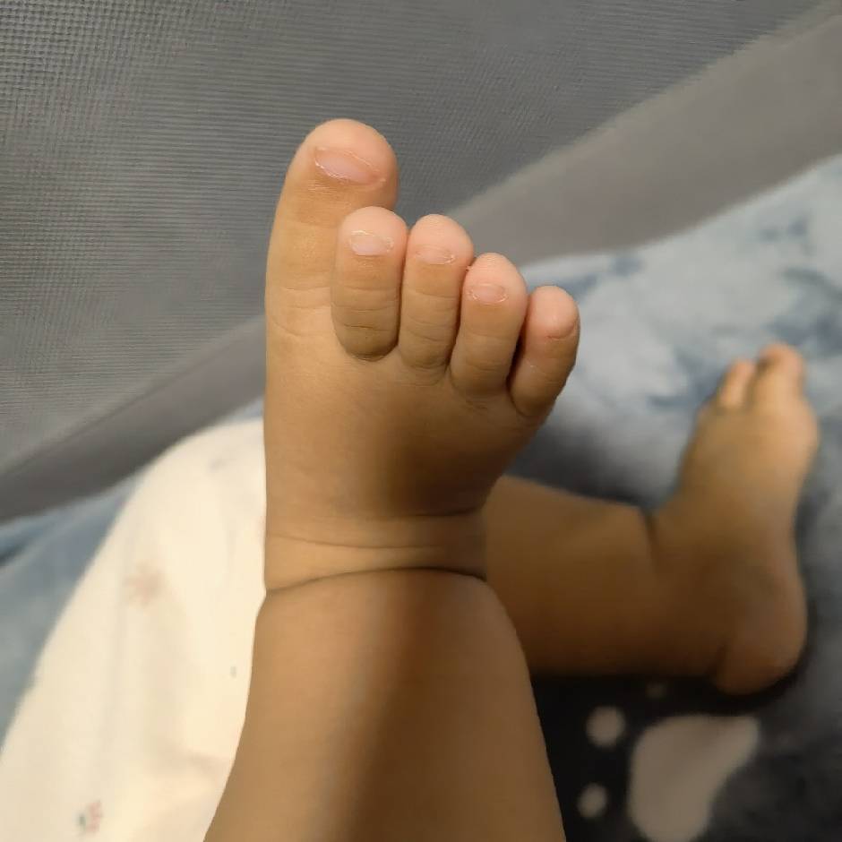 小胖